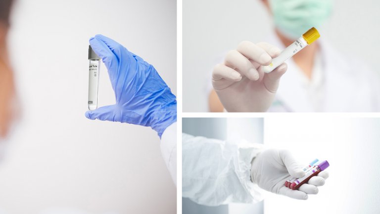 blood collection tube