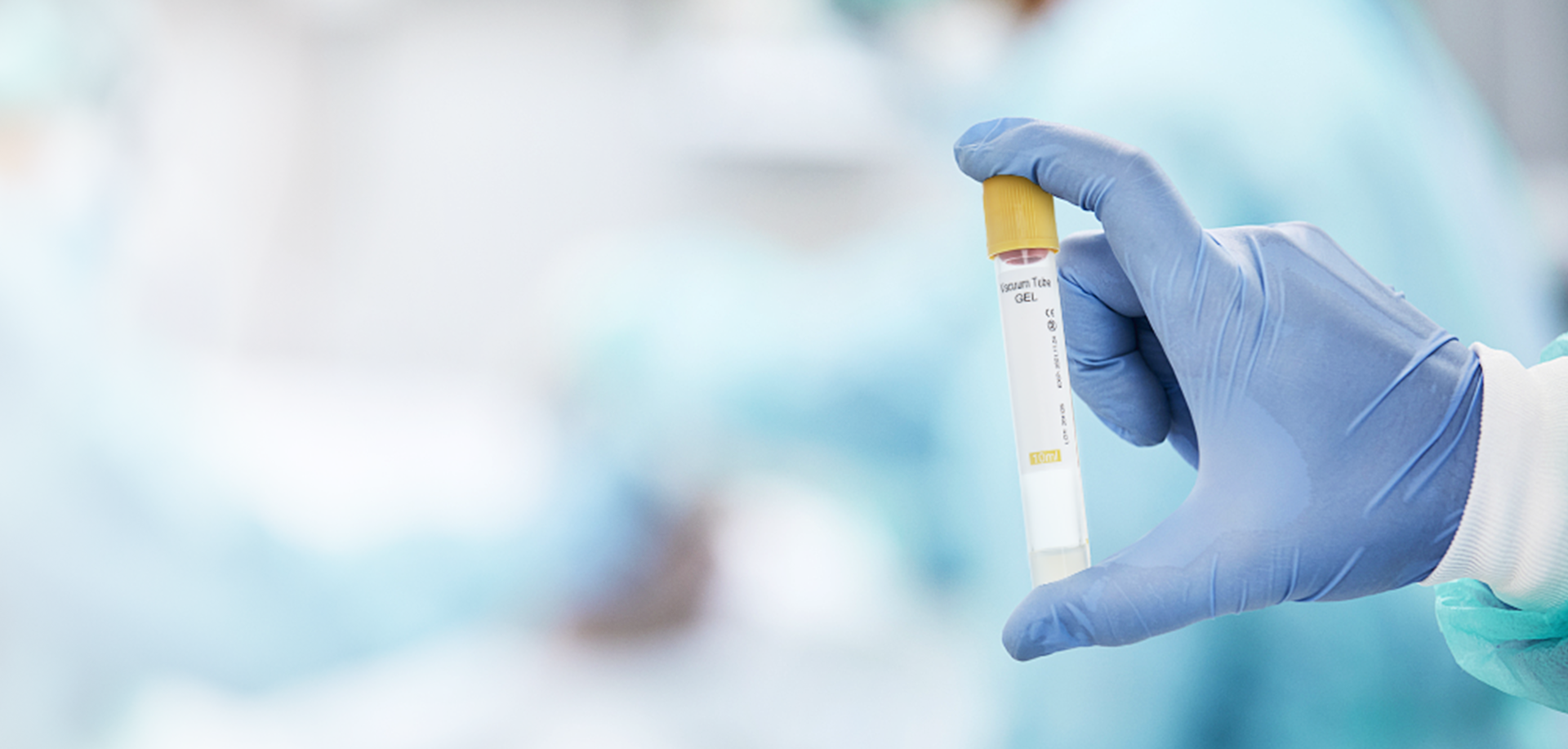 blood collection tube